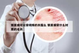 银屑病可以穿纯棉的衣服么 银屑病穿什么材质的毛衣