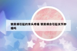 银屑病引起的骨头疼痛 银屑病会引起关节肿痛吗