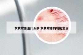 灰黄霉素治什么病 灰黄霉素的功能主治