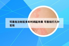可善挺注射后多长时间起效果 可善挺打几针见效