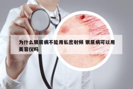 为什么银屑病不能用私密射频 银屑病可以用美容仪吗