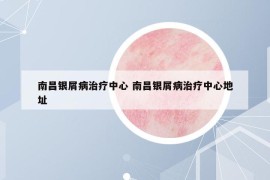 南昌银屑病治疗中心 南昌银屑病治疗中心地址