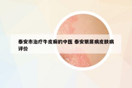 泰安市治疗牛皮癣的中医 泰安银屑病皮肤病评价