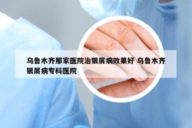 乌鲁木齐那家医院治银屑病效果好 乌鲁木齐银屑病专科医院