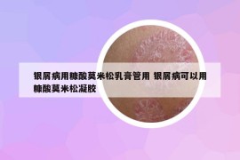 银屑病用糠酸莫米松乳膏管用 银屑病可以用糠酸莫米松凝胶
