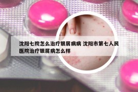 沈阳七院怎么治疗银屑病病 沈阳市第七人民医院治疗银屑病怎么样
