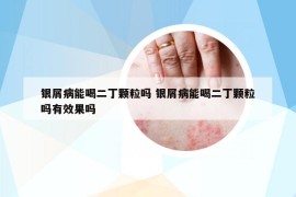 银屑病能喝二丁颗粒吗 银屑病能喝二丁颗粒吗有效果吗