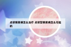 点状银屑病怎么治疗 点状型银屑病怎么引起的