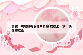 皮肤一块块红有点像牛皮癣 皮肤上一块一块像癣红色