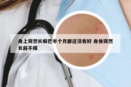 身上突然长癣巴半个月都还没有好 身体突然长藓不痒