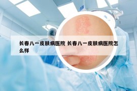 长春八一皮肤病医院 长春八一皮肤病医院怎么样