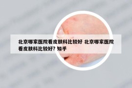 北京哪家医院看皮肤科比较好 北京哪家医院看皮肤科比较好? 知乎