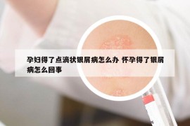 孕妇得了点滴状银屑病怎么办 怀孕得了银屑病怎么回事