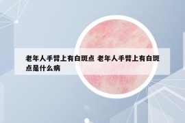 老年人手臂上有白斑点 老年人手臂上有白斑点是什么病