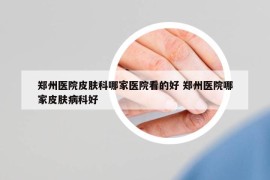 郑州医院皮肤科哪家医院看的好 郑州医院哪家皮肤病科好
