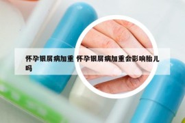 怀孕银屑病加重 怀孕银屑病加重会影响胎儿吗
