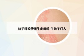 蚊子叮咬传播牛皮癣吗 牛蚊子叮人