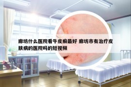 廊坊什么医院看牛皮癣最好 廊坊市有治疗皮肤病的医院吗的短视频