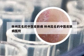 林州出名的中医皮肤病 林州出名的中医皮肤病医院