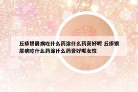 丘疹银屑病吃什么药涂什么药膏好呢 丘疹银屑病吃什么药涂什么药膏好呢女性