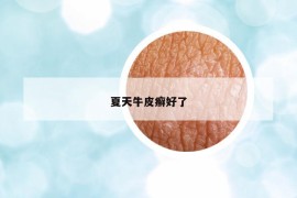 夏天牛皮癣好了