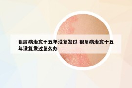 银屑病治愈十五年没复发过 银屑病治愈十五年没复发过怎么办