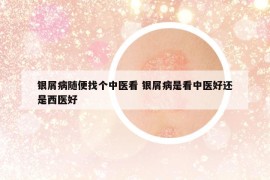 银屑病随便找个中医看 银屑病是看中医好还是西医好