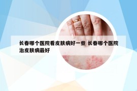 长春哪个医院看皮肤病好一些 长春哪个医院治皮肤病最好