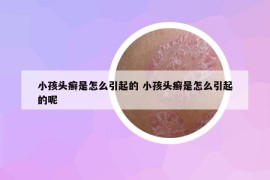小孩头癣是怎么引起的 小孩头癣是怎么引起的呢