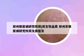 郑州银屑病研究院择j周文敬品质 郑州市银屑病研究所周文静医生