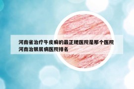 河南省治疗牛皮癣的最正规医院是那个医院 河南治银屑病医院排名
