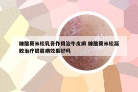 糠酸莫米松乳膏作用治牛皮癣 糠酸莫米松凝胶治疗银屑病效果好吗