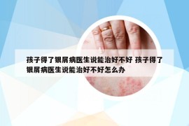 孩子得了银屑病医生说能治好不好 孩子得了银屑病医生说能治好不好怎么办