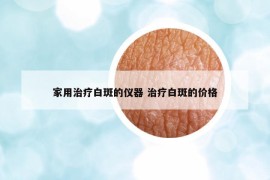 家用治疗白斑的仪器 治疗白斑的价格