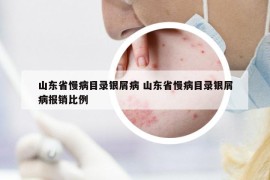 山东省慢病目录银屑病 山东省慢病目录银屑病报销比例