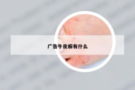 广告牛皮癣有什么