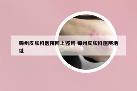 锦州皮肤科医院网上咨询 锦州皮肤科医院地址