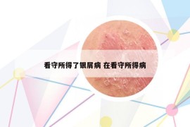 看守所得了银屑病 在看守所得病