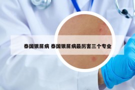 泰国银屑病 泰国银屑病最厉害三个专业