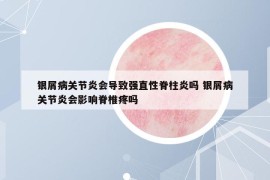 银屑病关节炎会导致强直性脊柱炎吗 银屑病关节炎会影响脊椎疼吗