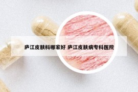 庐江皮肤科哪家好 庐江皮肤病专科医院