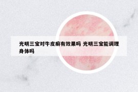 光明三宝对牛皮癣有效果吗 光明三宝能调理身体吗