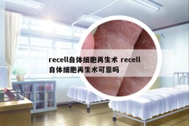 recell自体细胞再生术 recell自体细胞再生术可靠吗