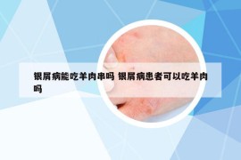 银屑病能吃羊肉串吗 银屑病患者可以吃羊肉吗