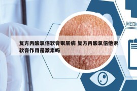 复方丙酸氯倍软膏银屑病 复方丙酸氯倍他索软膏作用是激素吗