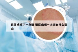 银屑病喝了一点酒 银屑病喝一次酒有什么影响