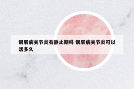 银屑病关节炎有静止期吗 银屑病关节炎可以活多久