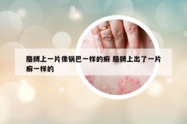 胳膊上一片像锅巴一样的癣 胳膊上出了一片癣一样的