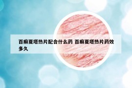 百癣夏塔热片配合什么药 百癣夏塔热片药效多久