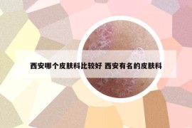 西安哪个皮肤科比较好 西安有名的皮肤科